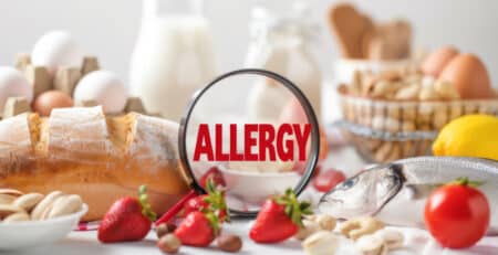 food allergy warning labels